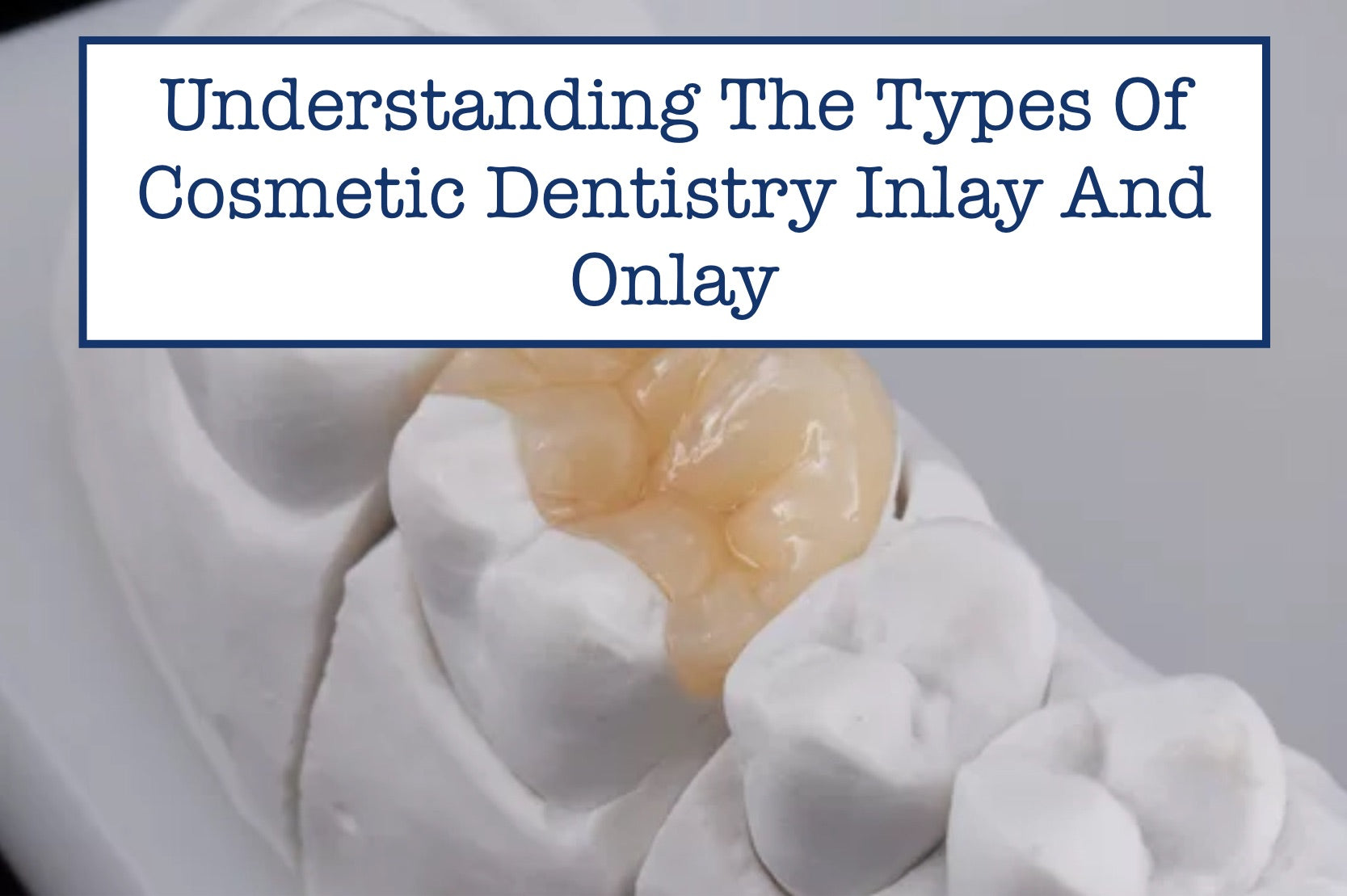 Understanding The Types Of Cosmetic Dentistry Inlay And Onlay