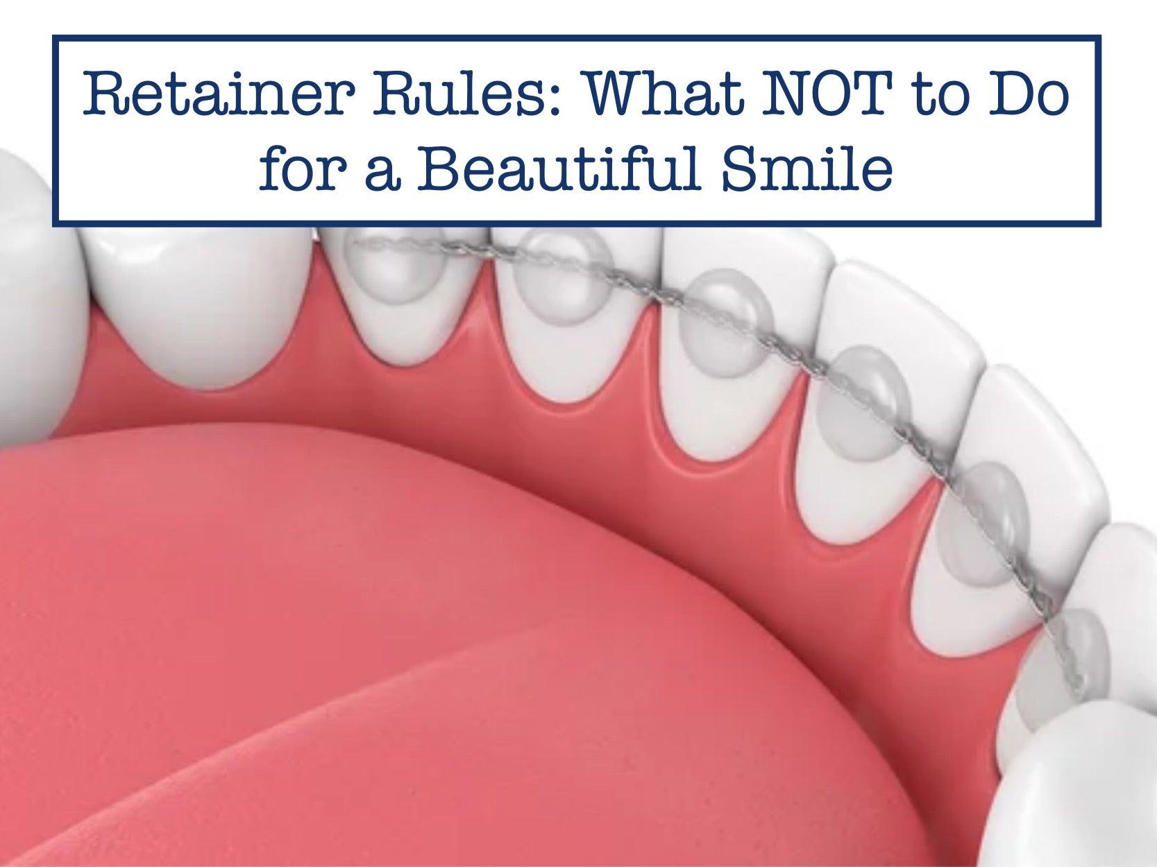 Retainer Rules What NOT to Do for a Beautiful Smile