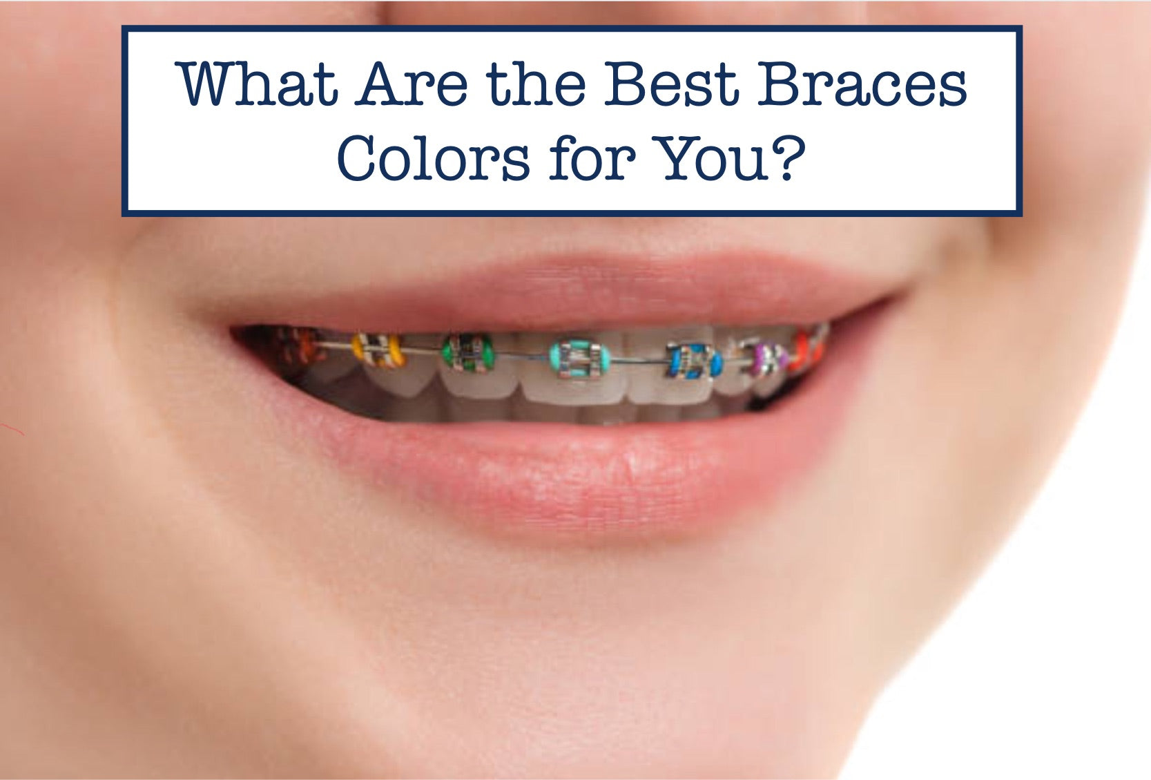 What Are the Best Braces Colors for You? B.WEISS Health