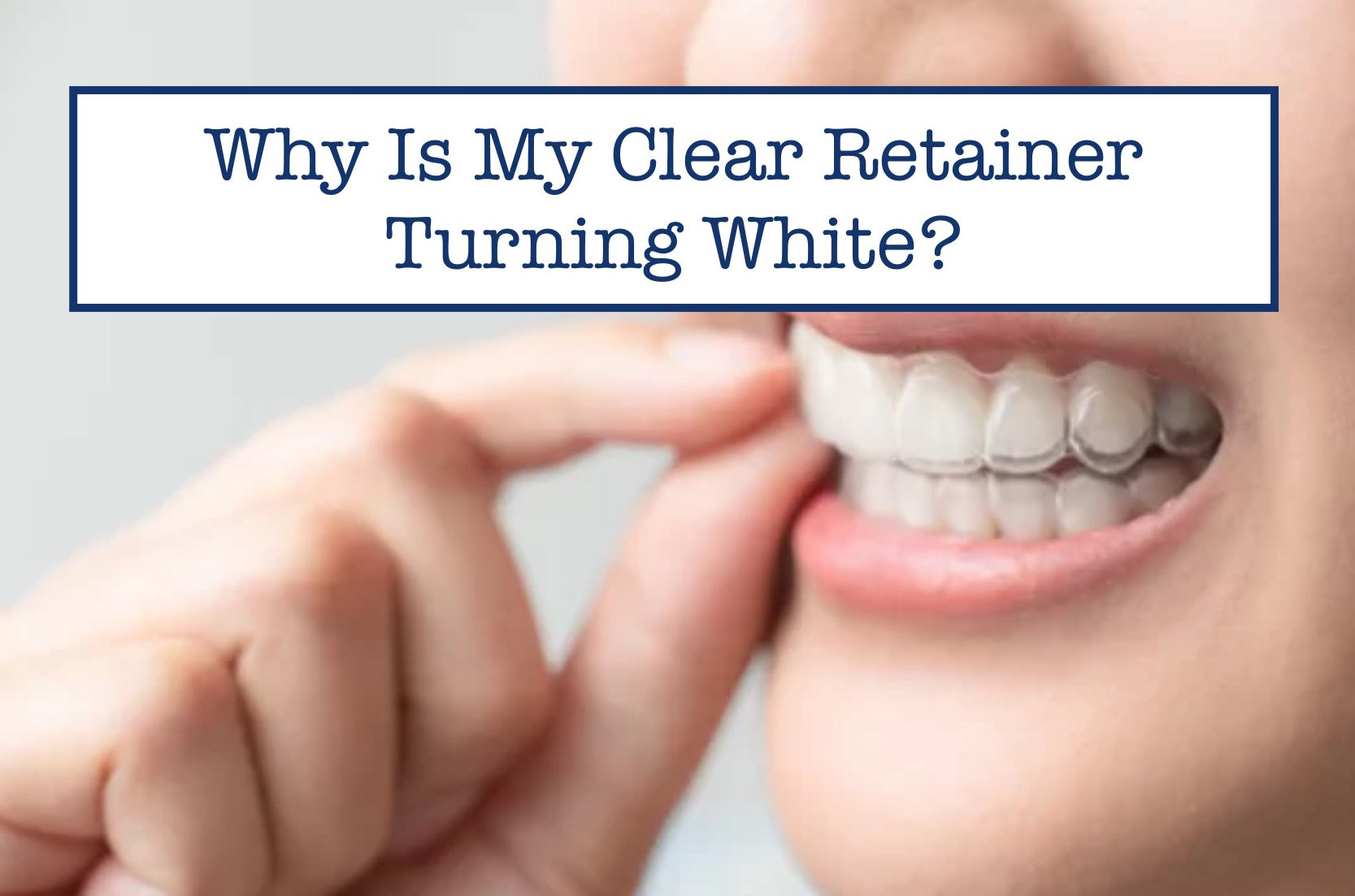 Why Is My Clear Retainer Turning White?