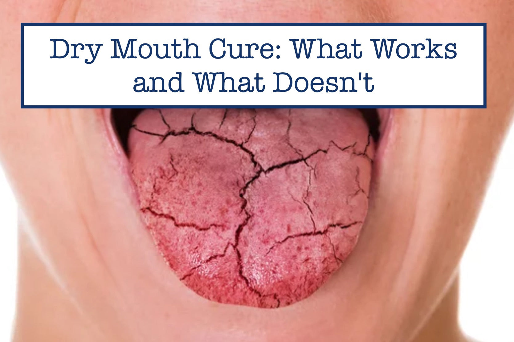 Dry Mouth Cure What Works and What Doesn't