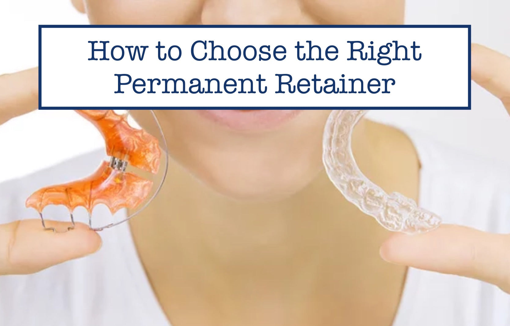 Permanent Retainer Near Me Options for Long-Term Orthodontic Results Permanent Retainer Near Me Options for Long-Term Orthodontic Results
