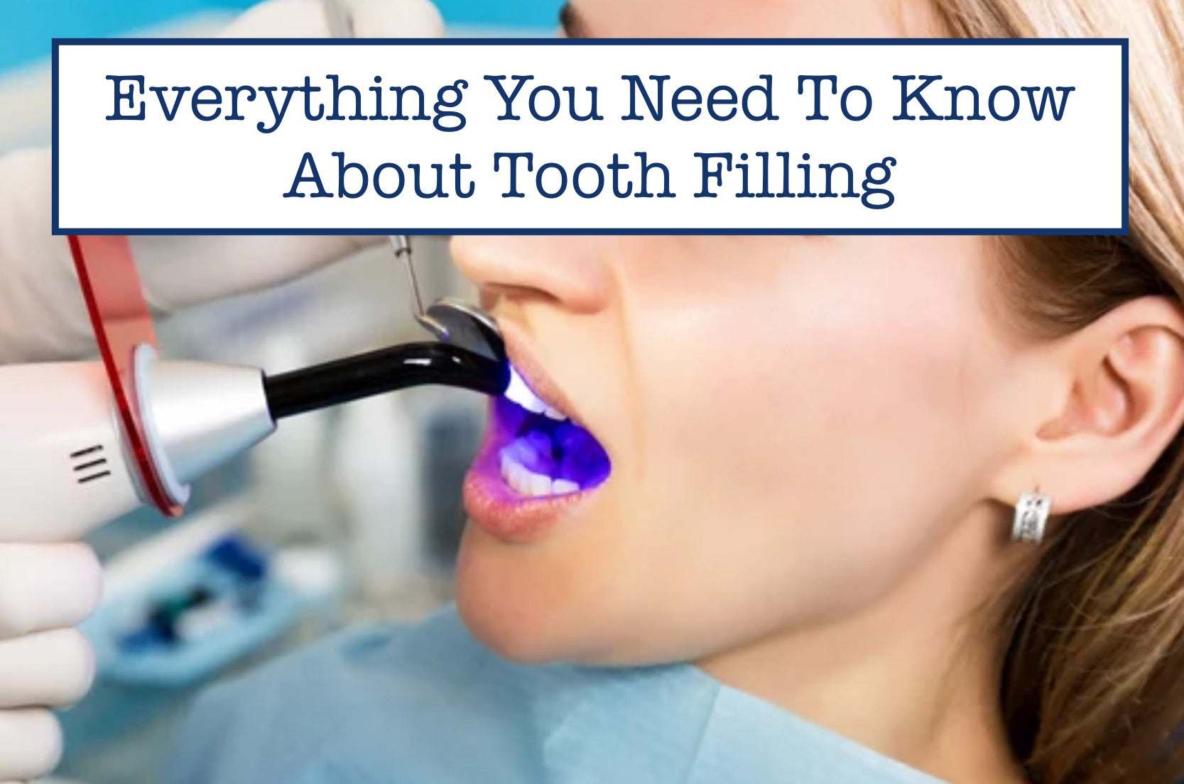 Everything about Tooth Filling