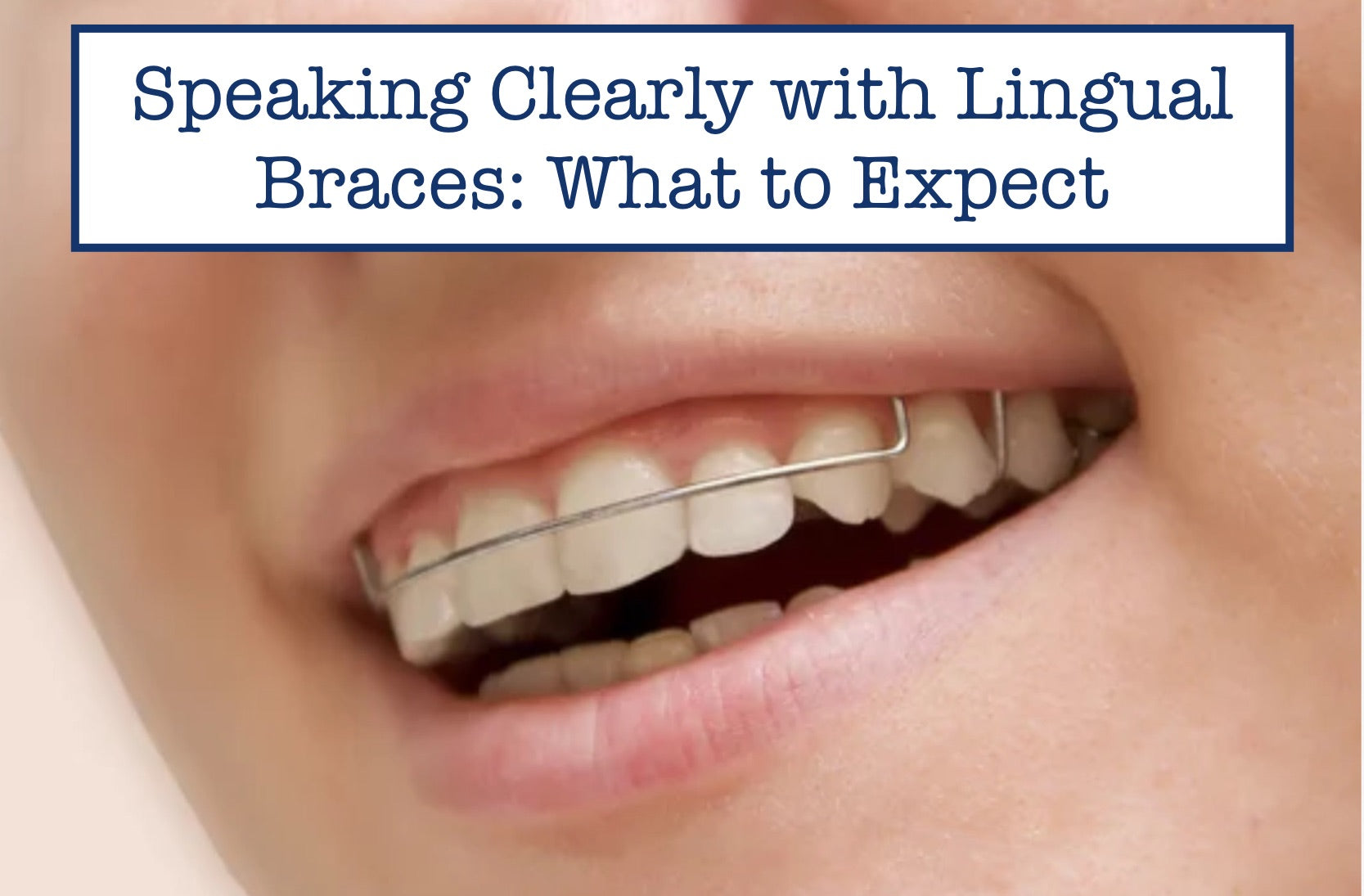 Speaking Clearly with Lingual Braces What to Expect
