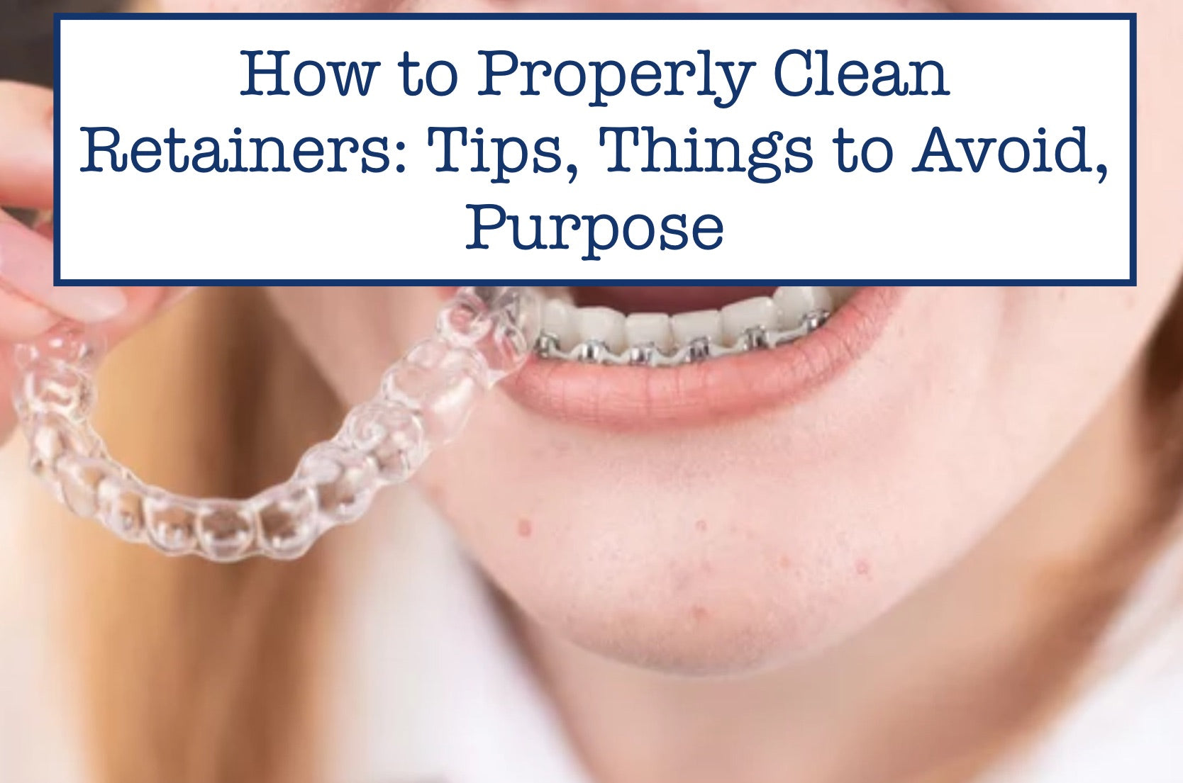 How to Properly Clean Retainers Tips, Things to Avoid, Purpose