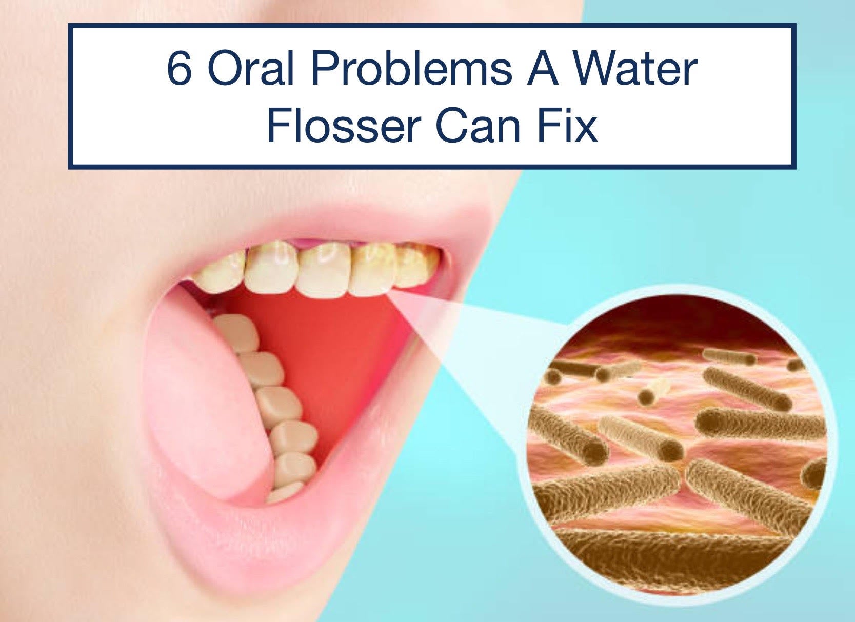 6 Oral Problems A Water Flosser Can Fix – B.WEISS Health
