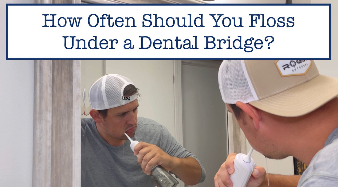 How Often Should You Floss Under a Dental Bridge?