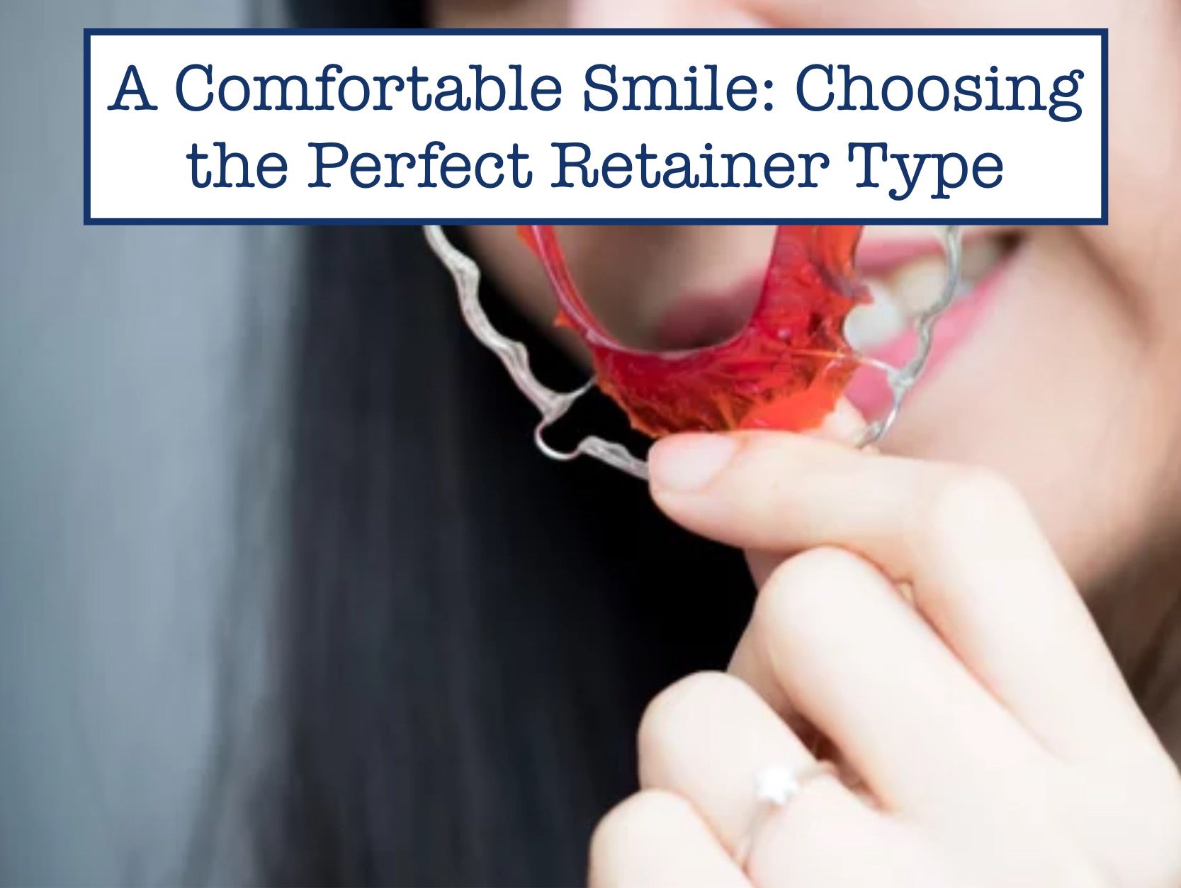 A Comfortable Smile: Choosing the Perfect Retainer Type
