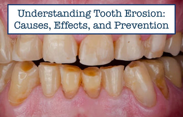 Understanding Tooth Erosion: Causes, Effects, and Prevention