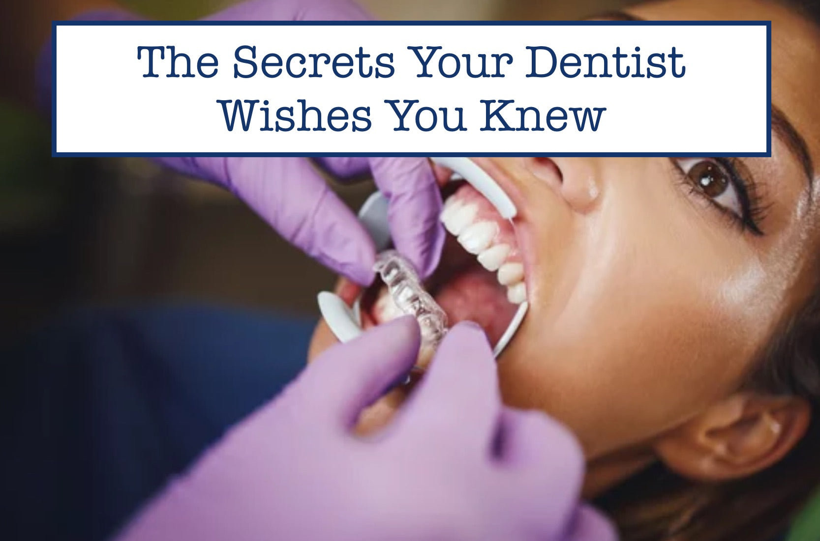 The Secrets Your Dentist Wishes You Knew