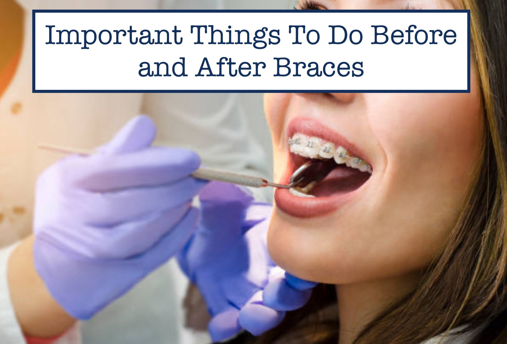 Important Things to Do Before and After Braces 