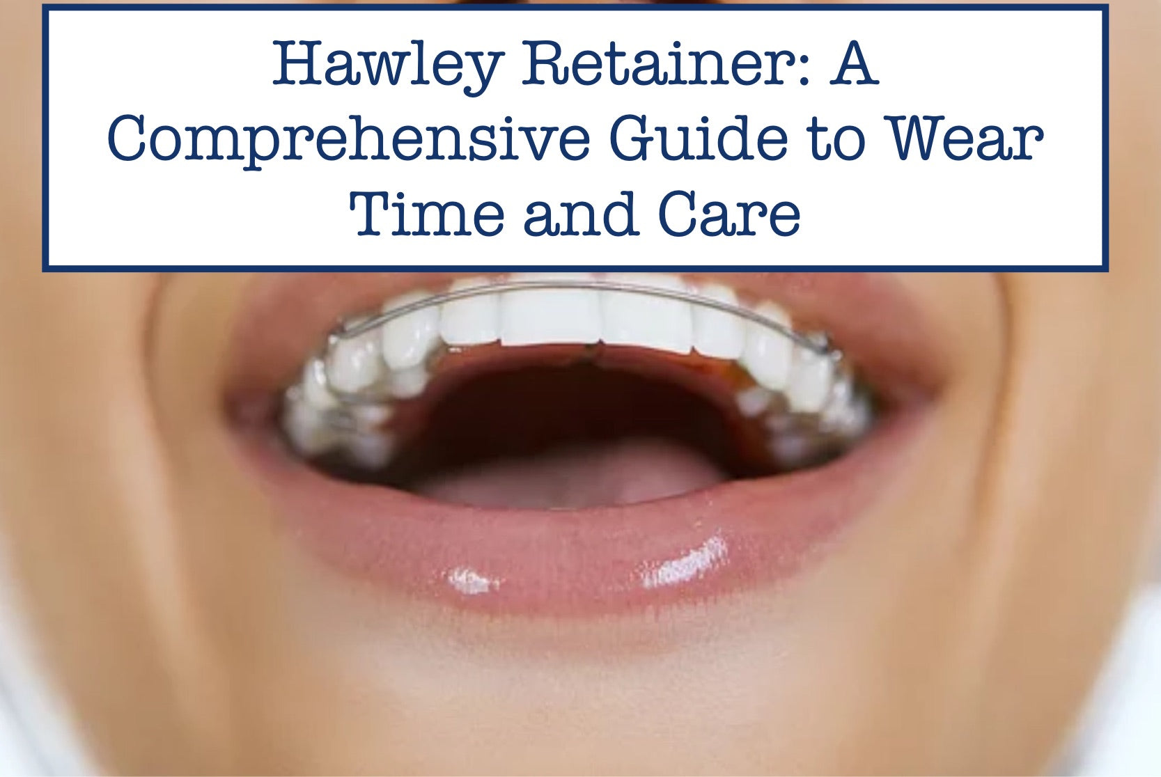 Hawley Retainer Instructions.pdf Hawley Retainer Care Over Time: What You Need to Know