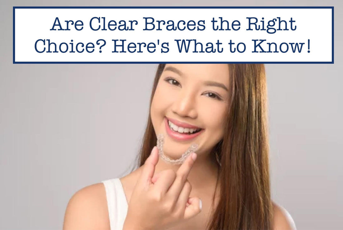 Are Clear Braces the Right Choice? Here's What to Know!