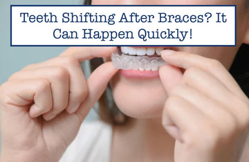 Teeth Shifting After Braces? It Can Happen Quickly!