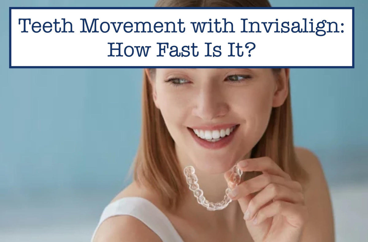 Movemint Invisalign Teeth Movement with Invisalign: How Fast Is It? – B.WEISS Health