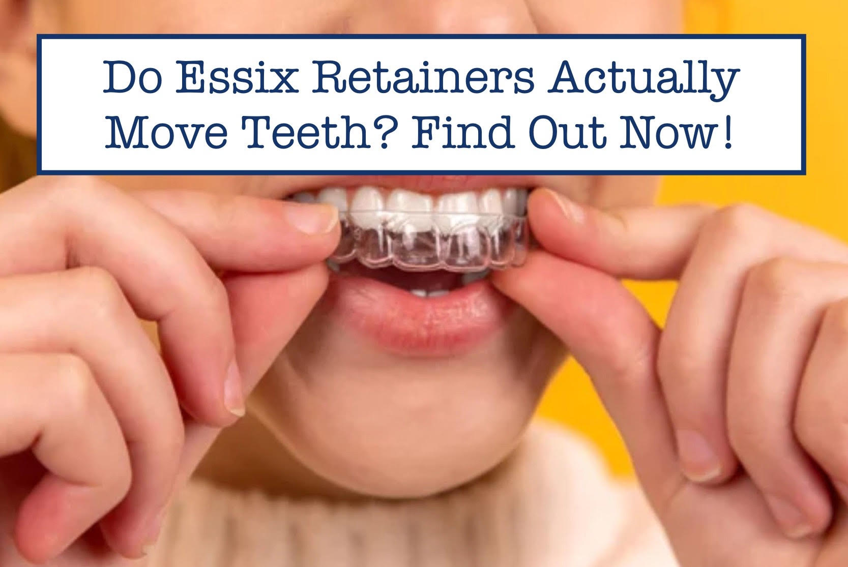 Do Essix Retainers Actually Move Teeth? Find Out Now! – B.WEISS Health