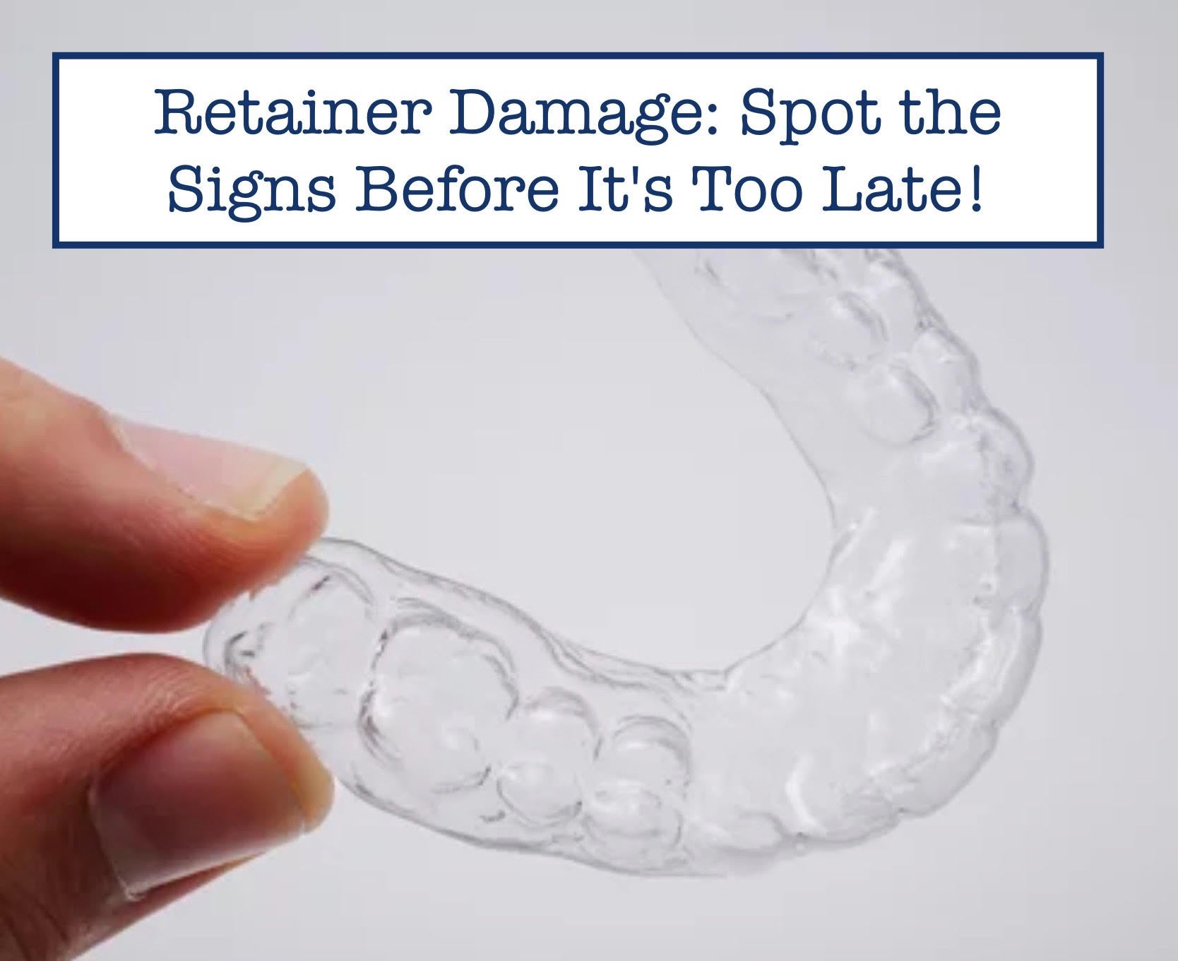Retainer Damage: Spot the Signs Before It's Too Late! – B.WEISS Health