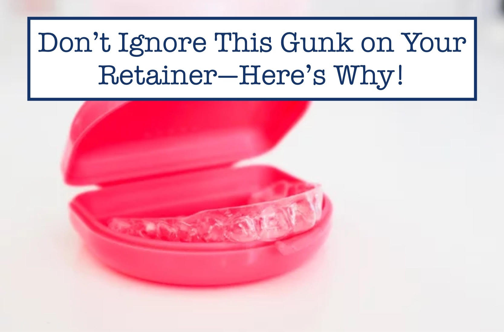 Don’t Ignore This Gunk on Your Retainer—Here’s Why! – B.WEISS Health
