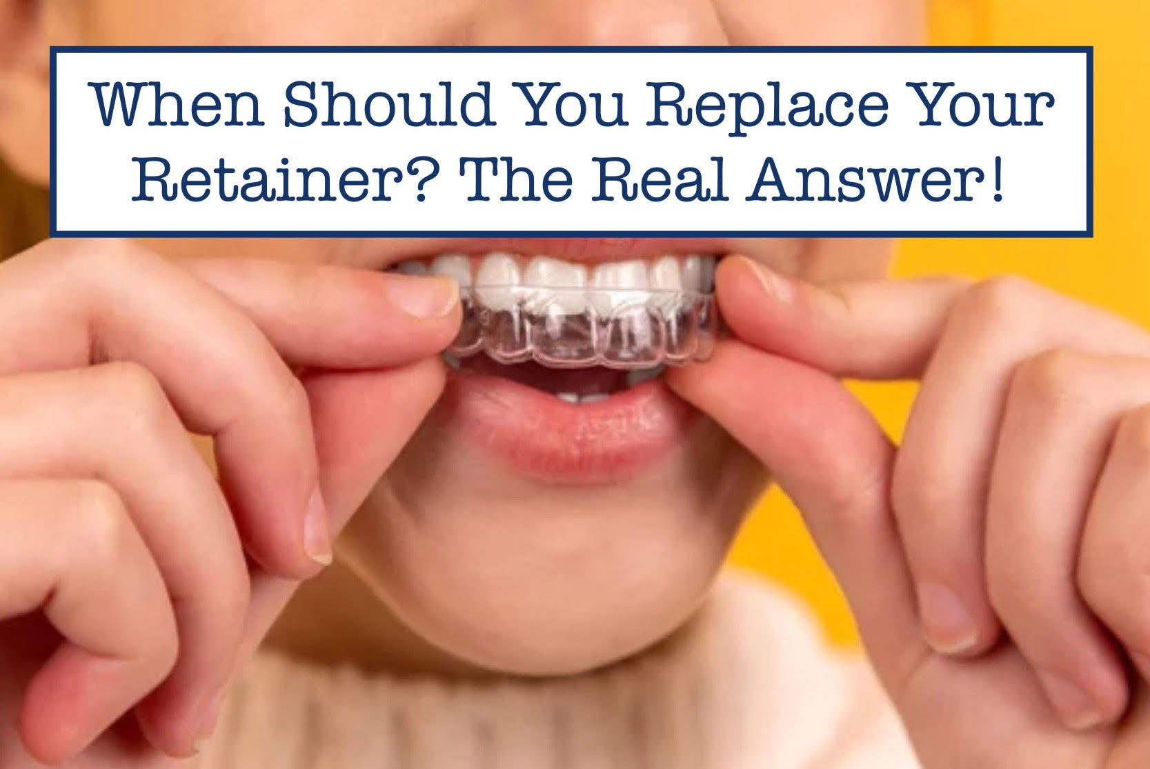 When Should You Replace Your Retainer? The Real Answer! – B.WEISS Health