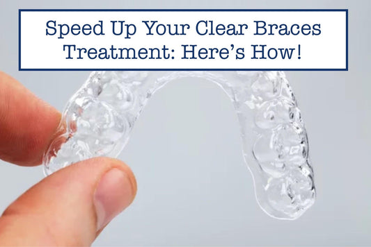 Speed Up Your Clear Braces Treatment: Here’s How!