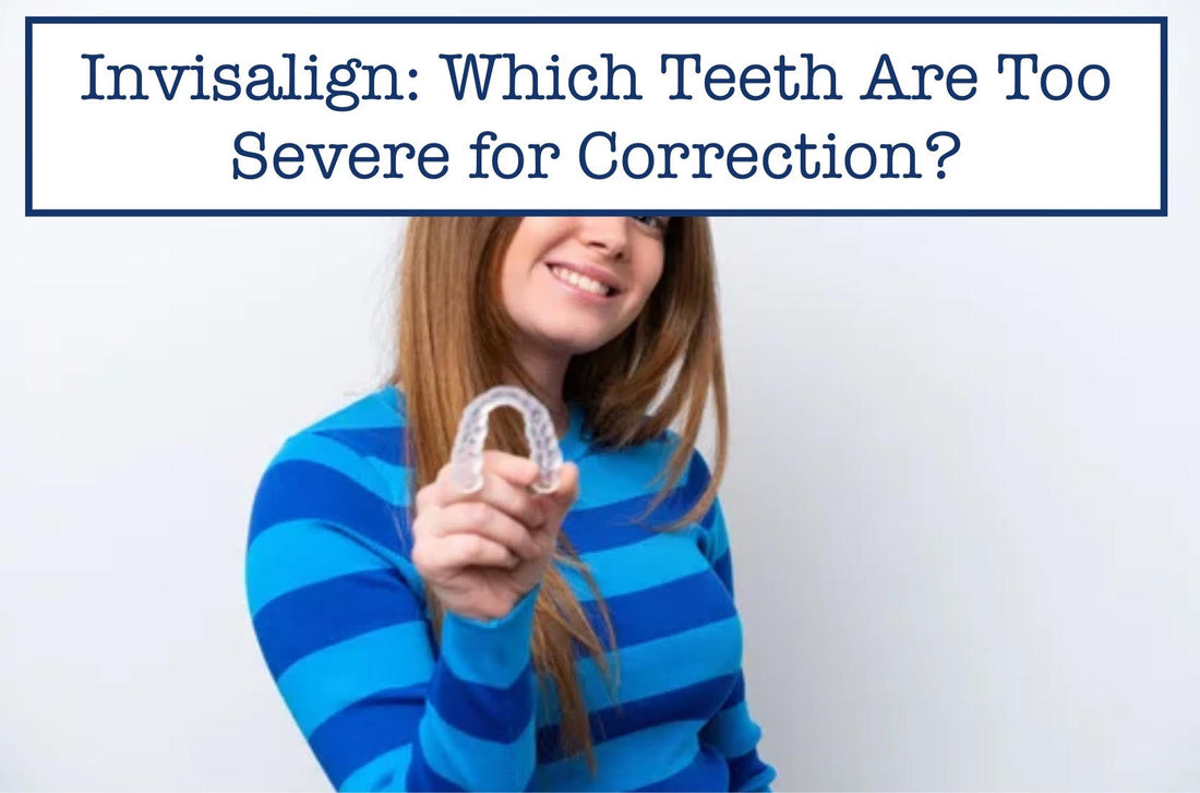 Invisalign: Which Teeth Are Too Severe for Correction?