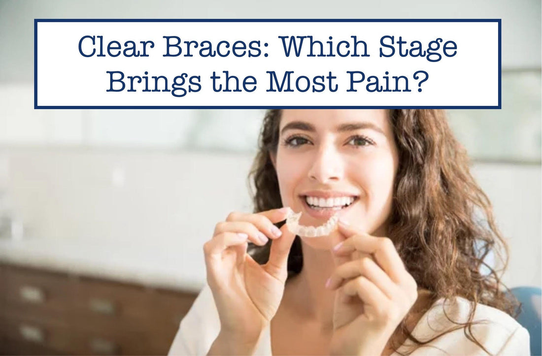 Clear Braces: Which Stage Brings the Most Pain?