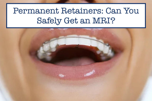 mouth with permanent retainers on