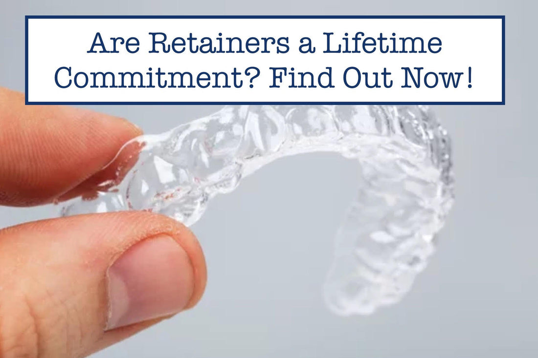 Are Retainers a Lifetime Commitment? Find Out Now!