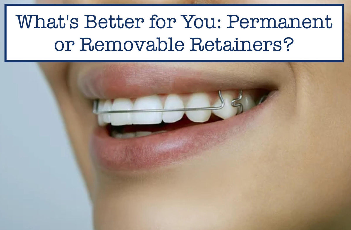 Revovable Retainer What's Better for You: Permanent or Removable Retainers? – B.WEISS Health