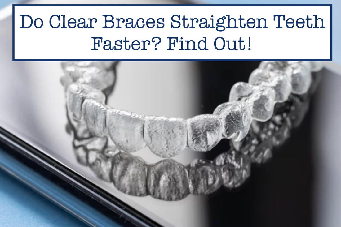 Do Clear Braces Straighten Teeth Faster? Find Out!