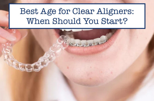 Best Age for Clear Aligners: When Should You Start?