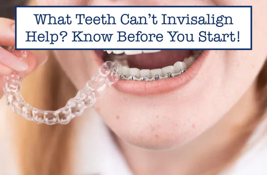 What Teeth Can’t Invisalign Help? Know Before You Start!