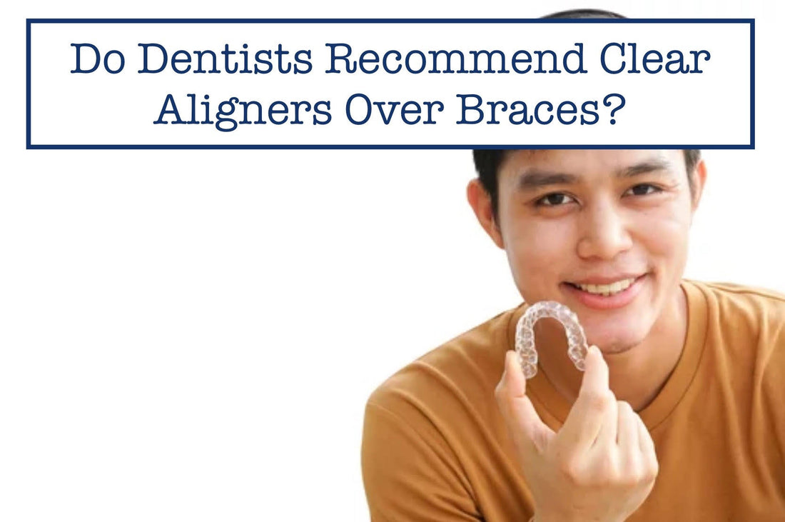 Do Dentists Recommend Clear Aligners Over Braces?