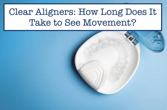 Clear Aligners: How Long Does It Take to See Movement?
