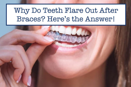 Why Do Teeth Flare Out After Braces? Here’s the Answer!