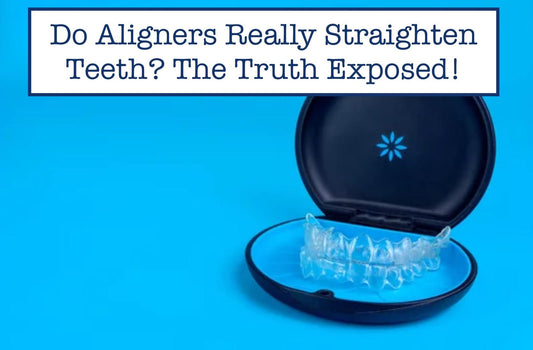 Do Aligners Really Straighten Teeth? The Truth Exposed!