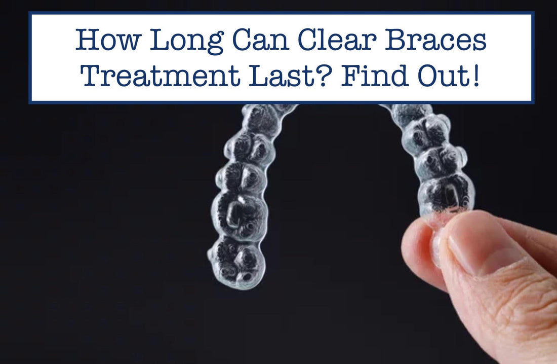 How Long Can Clear Braces Treatment Last? Find Out!