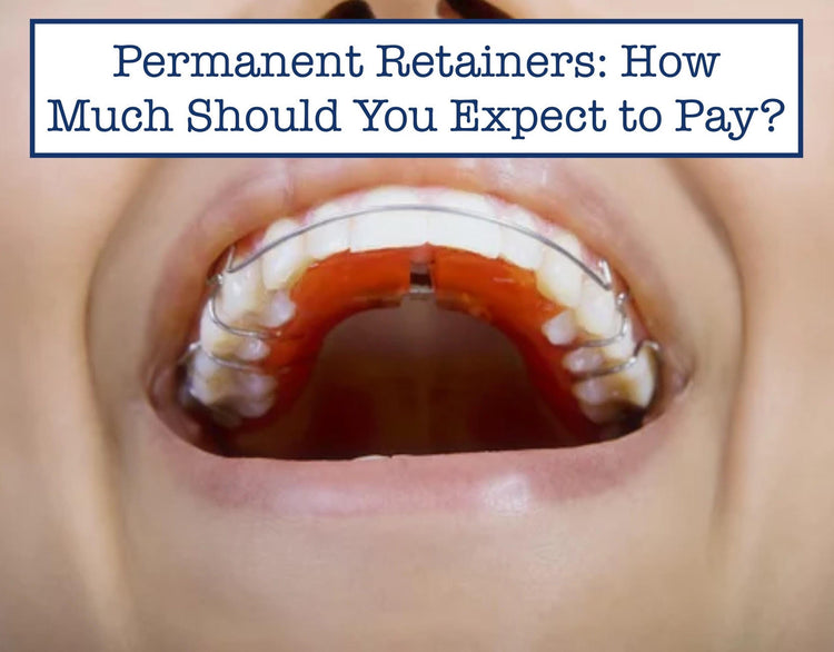 Permanent Retainers: How Much Should You Pay? – B.WEISS Health