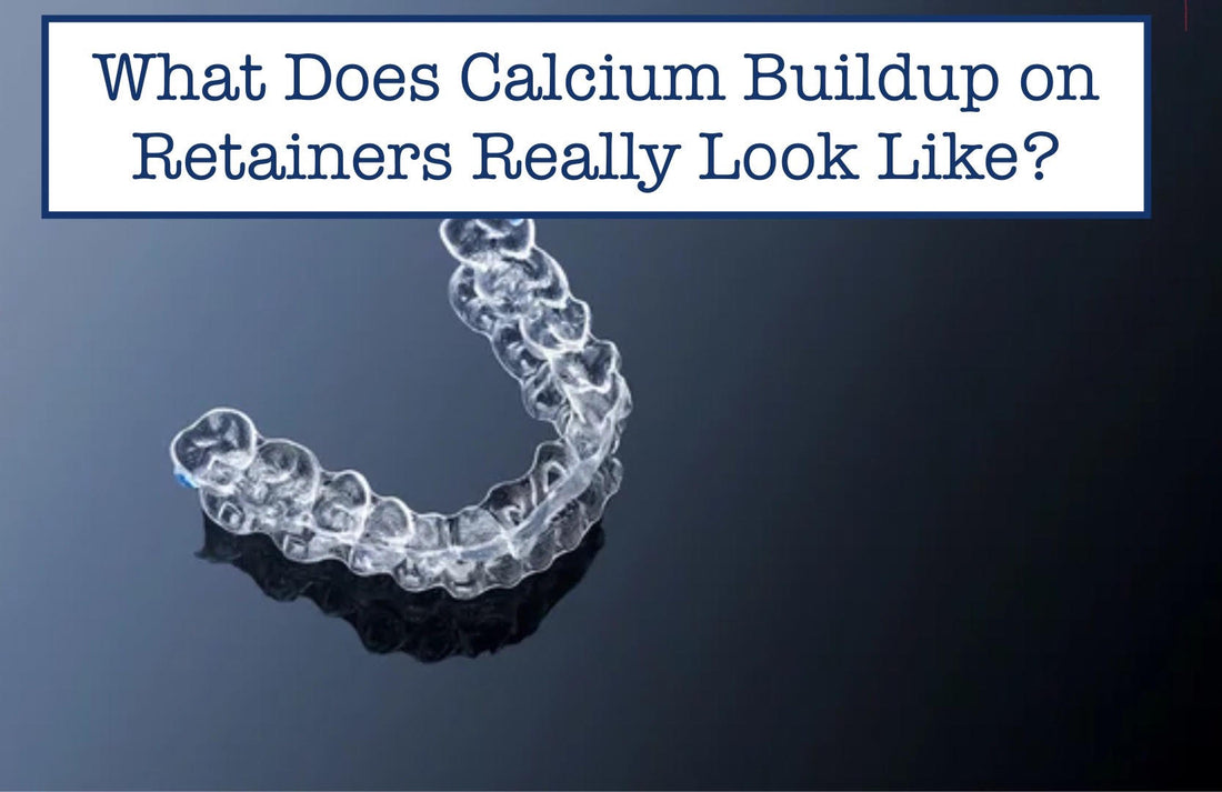 Calcium Buildup on Retainers