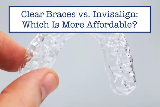 Clear Braces vs. Invisalign: Which Is More Affordable?