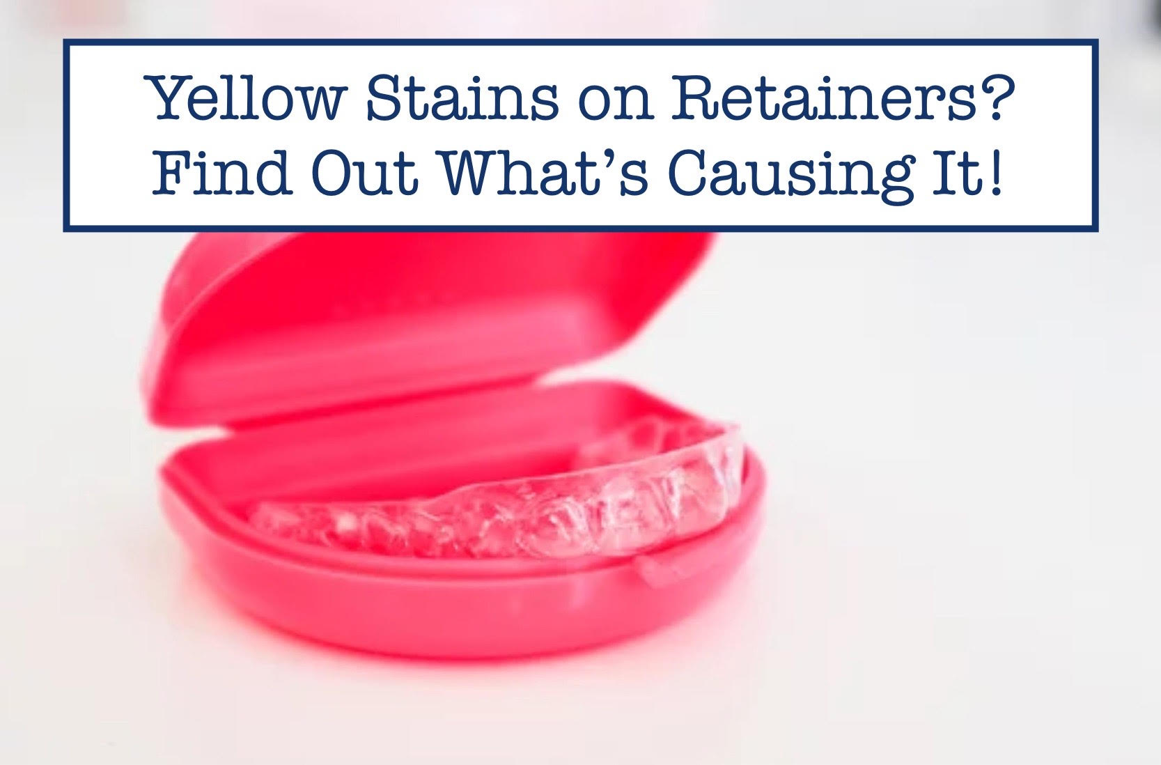 Retainer Yellow Yellow Stains on Retainers? Find Out What’s Causing It! – B.WEISS Health