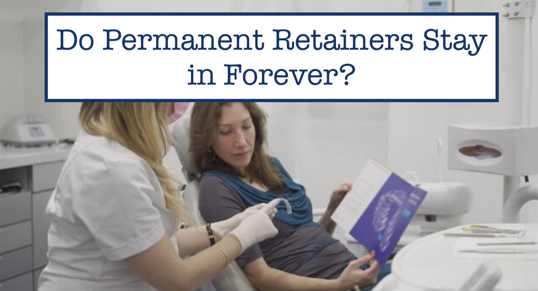 permanent retainers