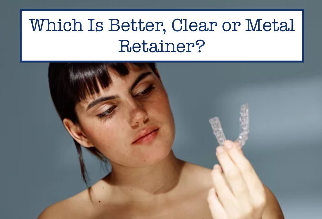 Which Is Better, Clear or Metal Retainer?