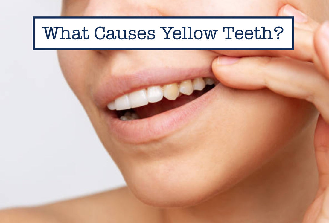 What Causes Yellow Teeth?