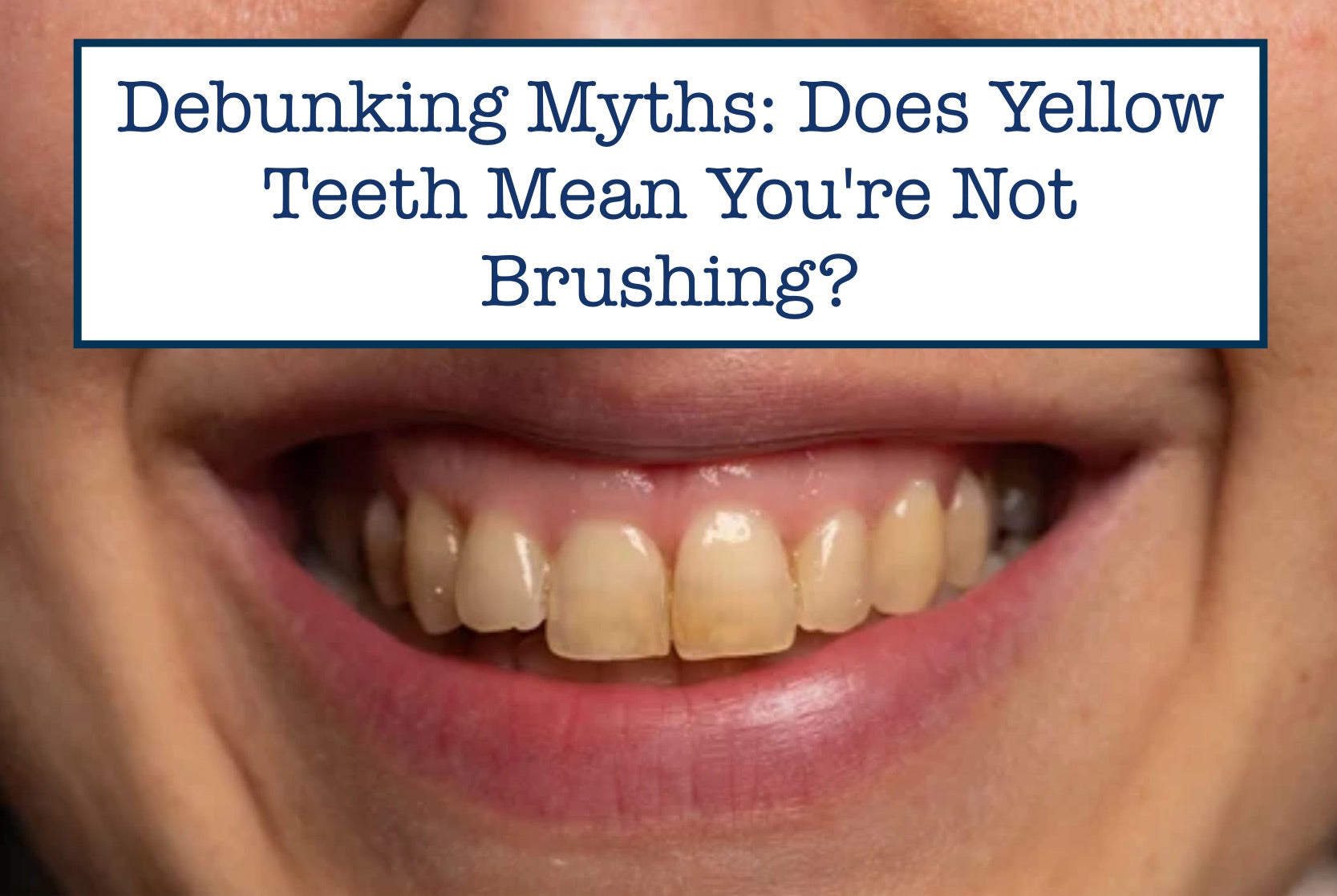 Debunking Myths: Does Yellow Teeth Mean You're Not Brushing?