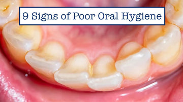 9 Signs of Poor Oral Hygiene