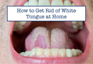 How to Get Rid of White Tongue at Home