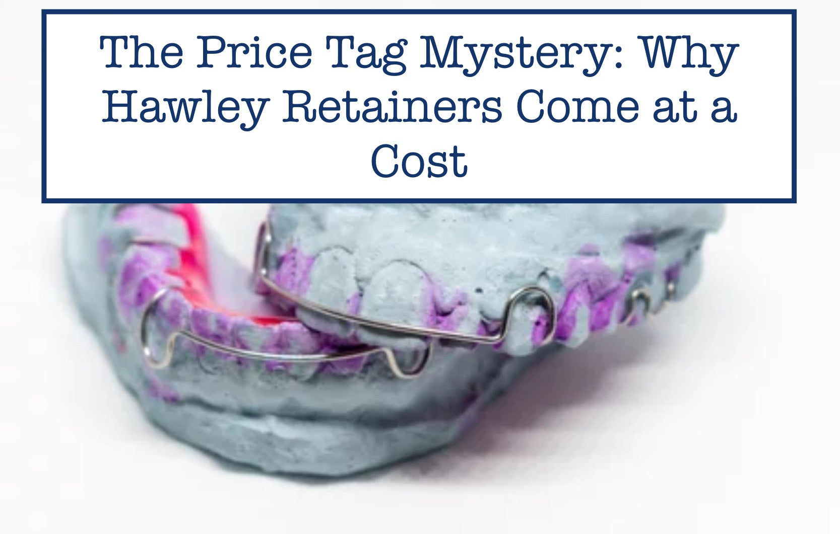 The Price Tag Mystery: Why Hawley Retainers Come at a Cost