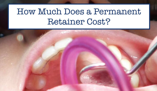 permanent retainer cost