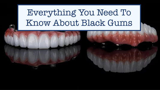 Everything You Need To Know About Black Gums: Causes, Treatments & Prevention